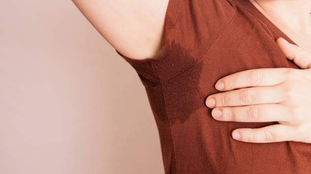 Toxina botulínica Hiperhidrosis (Sudoración excesiva) en Guadalajara